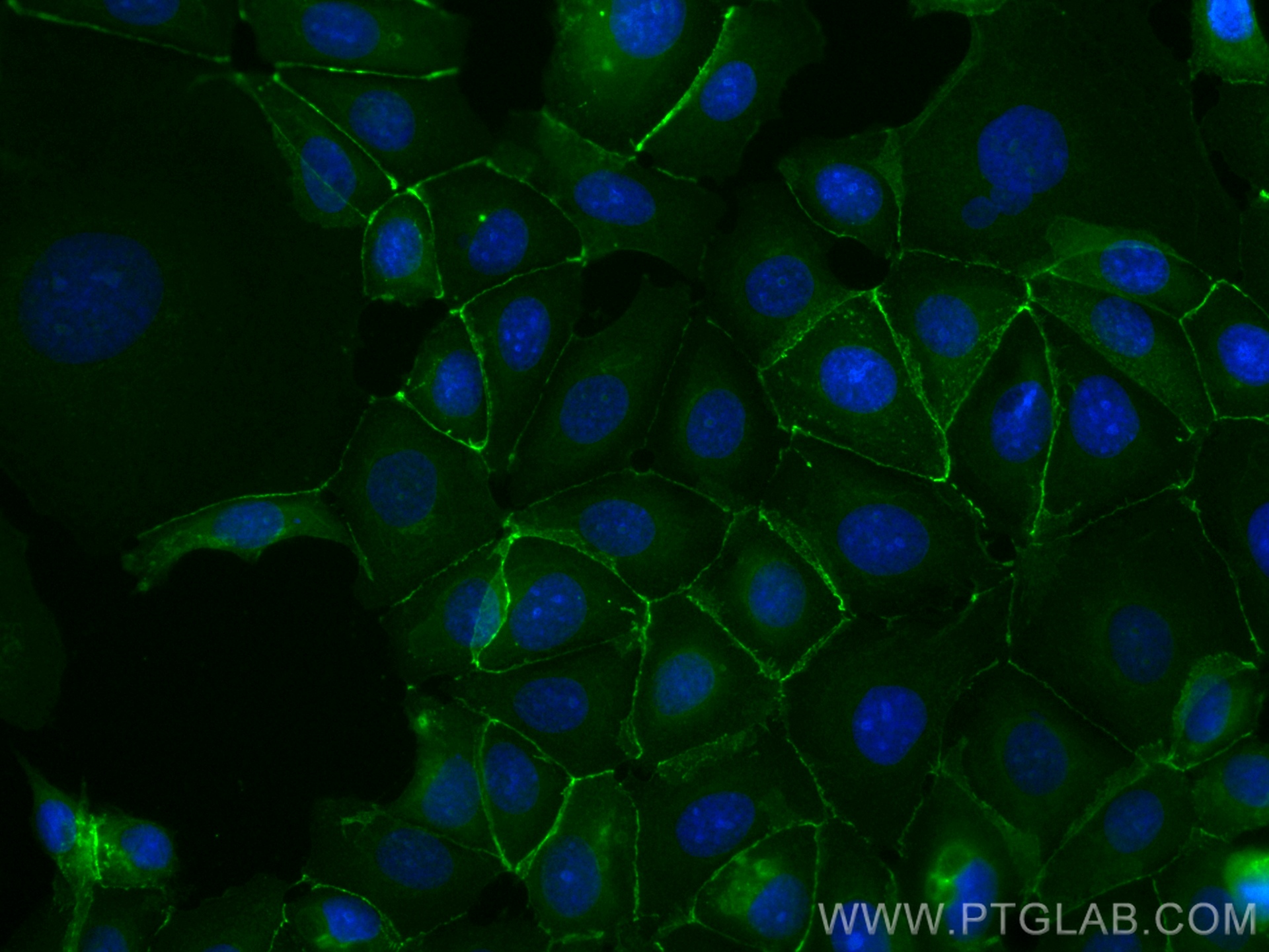 IF Staining of MCF-7 using CL488-80488