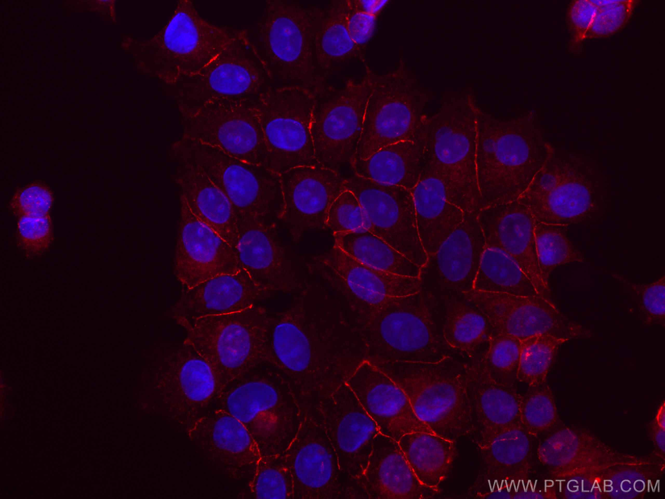 IF Staining of MCF-7 using CL555-51067