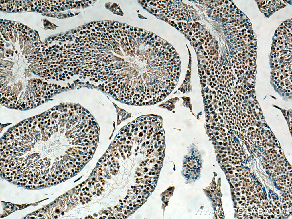 IHC staining of mouse testis using 28393-1-AP