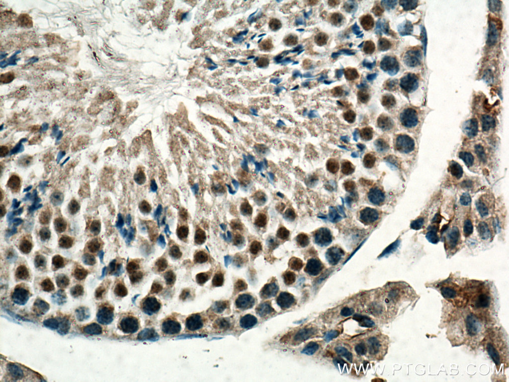 IHC staining of mouse testis using 28393-1-AP (same clone as 28393-1-PBS)