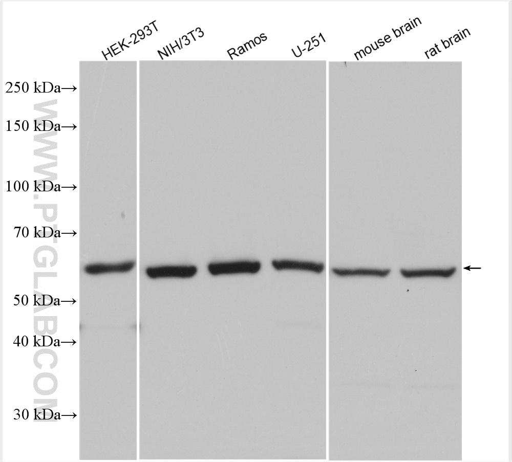 WB analysis using 28393-1-AP (same clone as 28393-1-PBS)