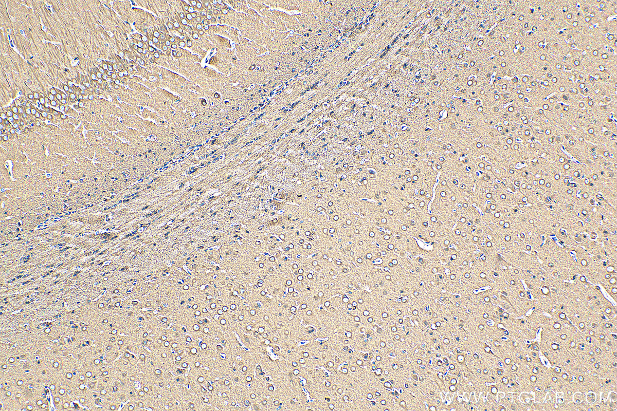 IHC staining of rat brain using 80713-1-RR