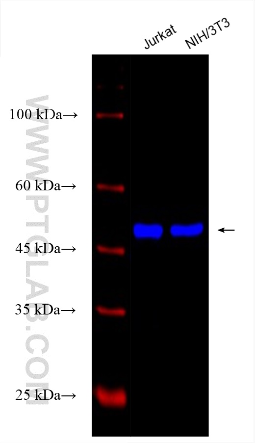 Beta Tubulin