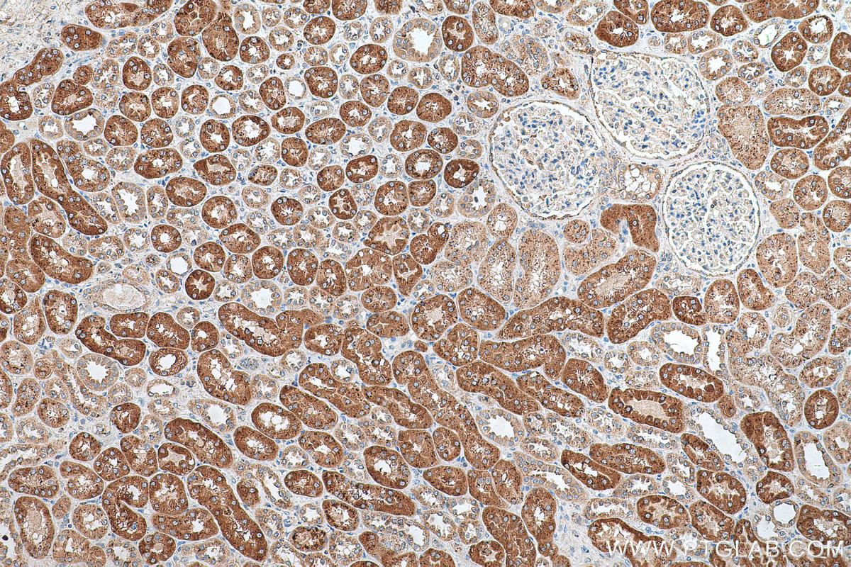 IHC staining of human kidney using 66586-1-Ig (same clone as 66586-1-PBS)