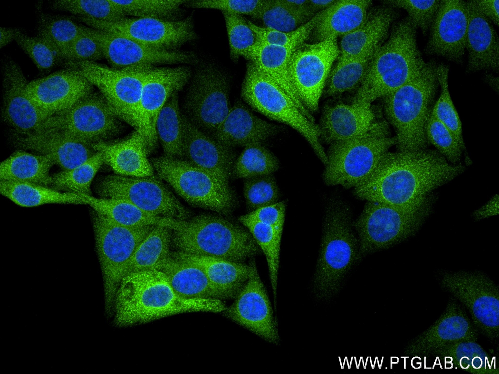 IF Staining of HepG2 using 83706-6-RR