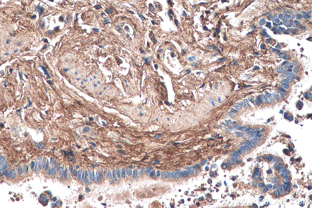 IHC staining of human lung using 67275-1-Ig