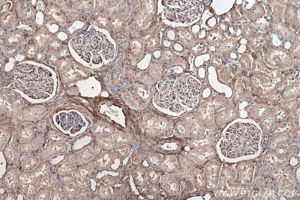 IHC staining of human kidney using 67275-1-Ig