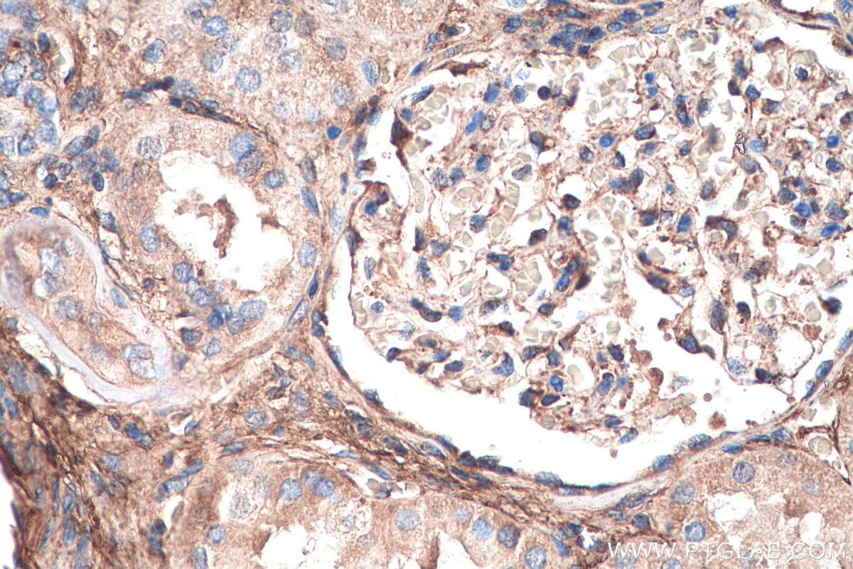 IHC staining of human kidney using 67275-1-Ig