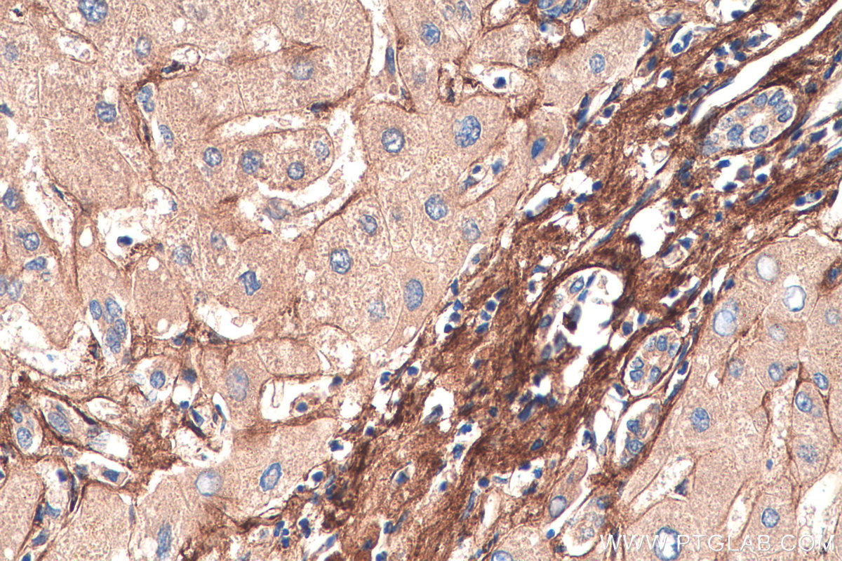 IHC staining of human liver using 67275-1-Ig
