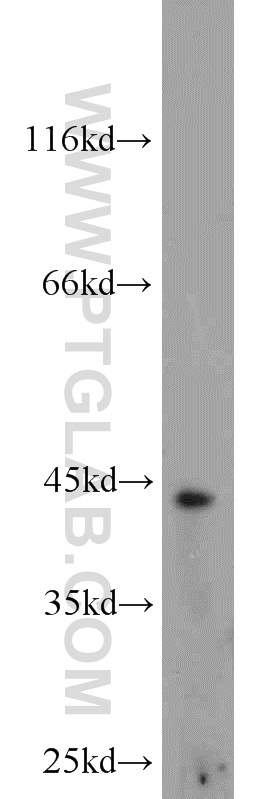 WB analysis of mouse liver using 20741-1-AP