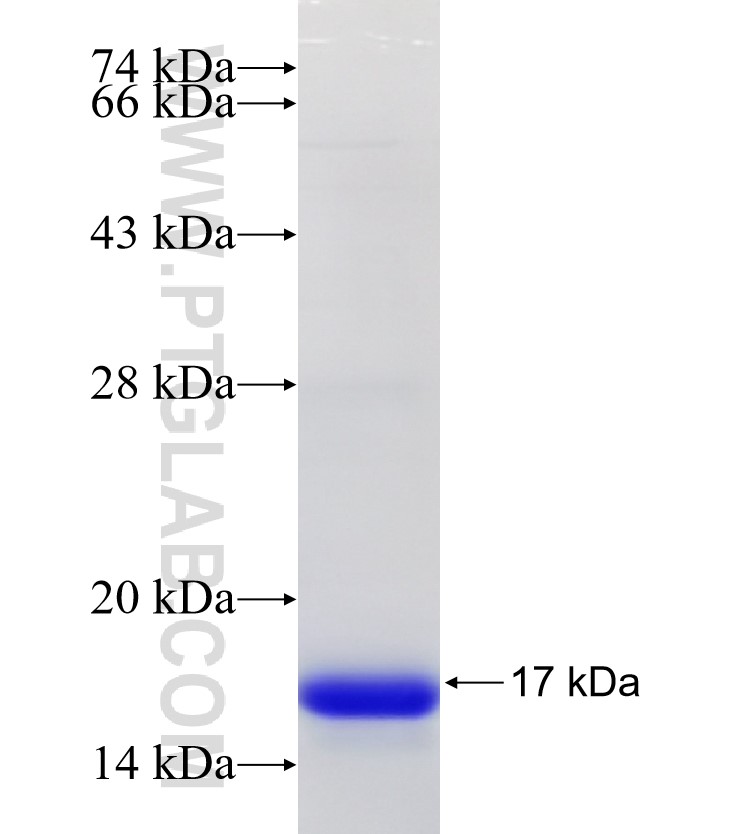 Brachyury-T fusion protein Ag31111 SDS-PAGE
