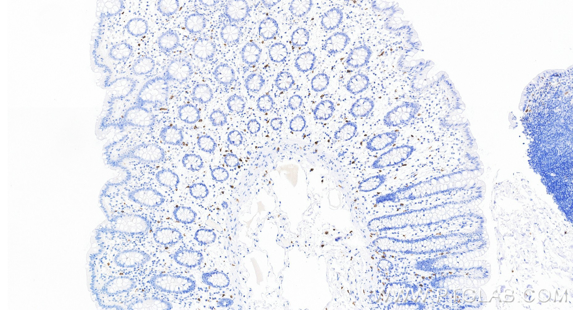IHC staining of human colon using 84259-11-RR IHC staining of human colon using 84259-11-RR