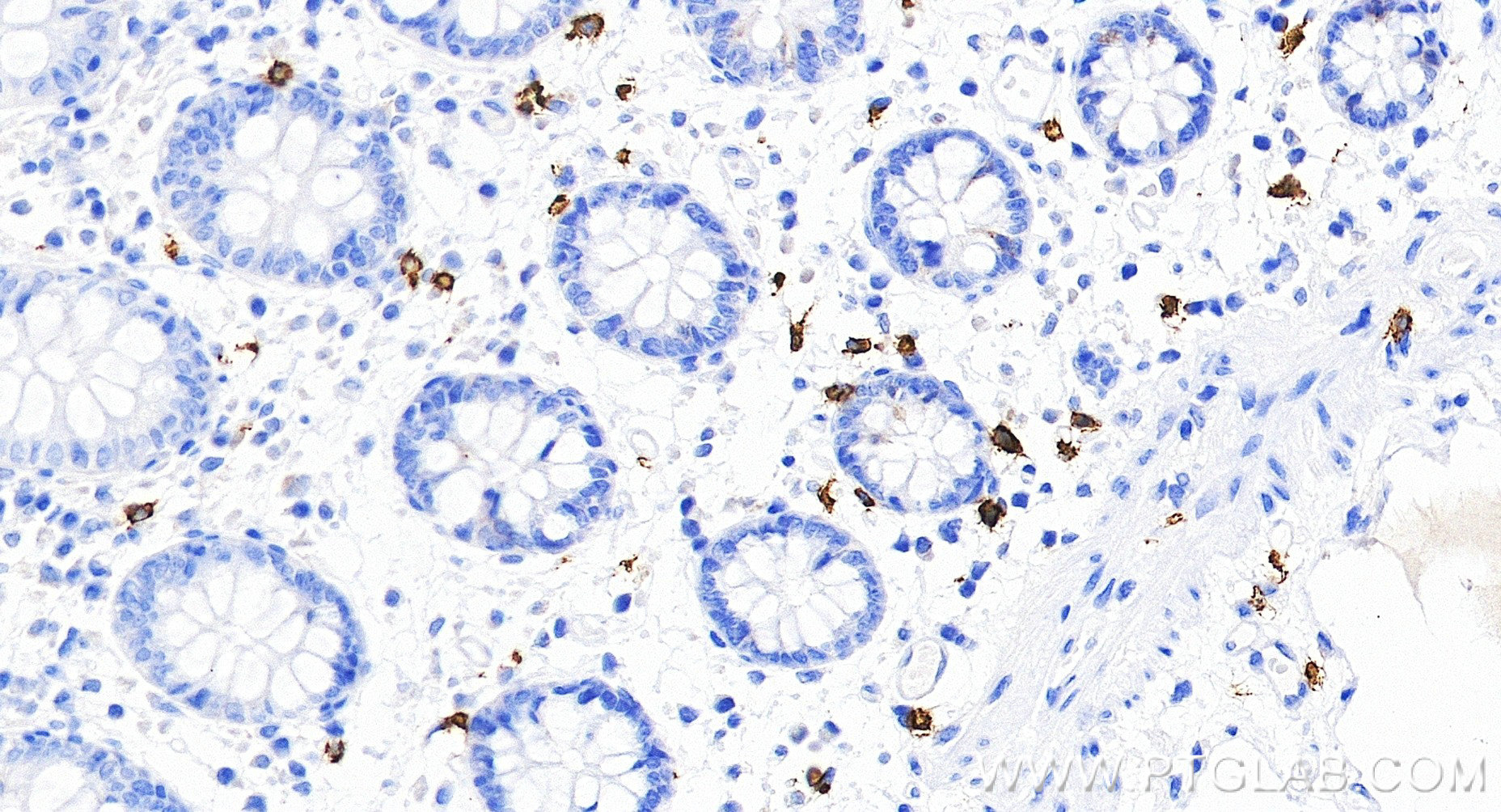 IHC staining of human colon using 84259-11-RR IHC staining of human colon using 84259-11-RR