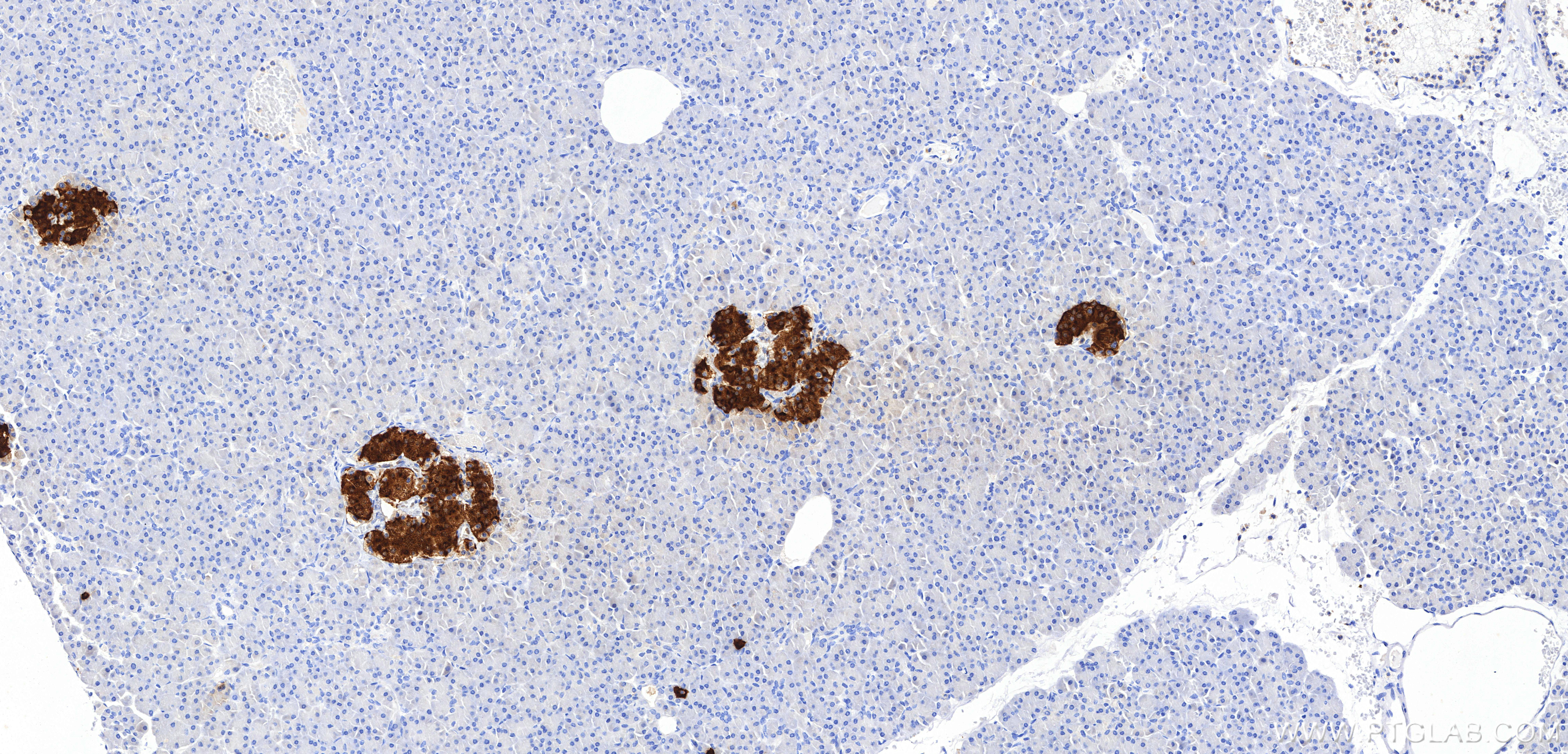 IHC staining of human pancreas using 98867-1-RR IHC staining of human pancreas using 98867-1-RR