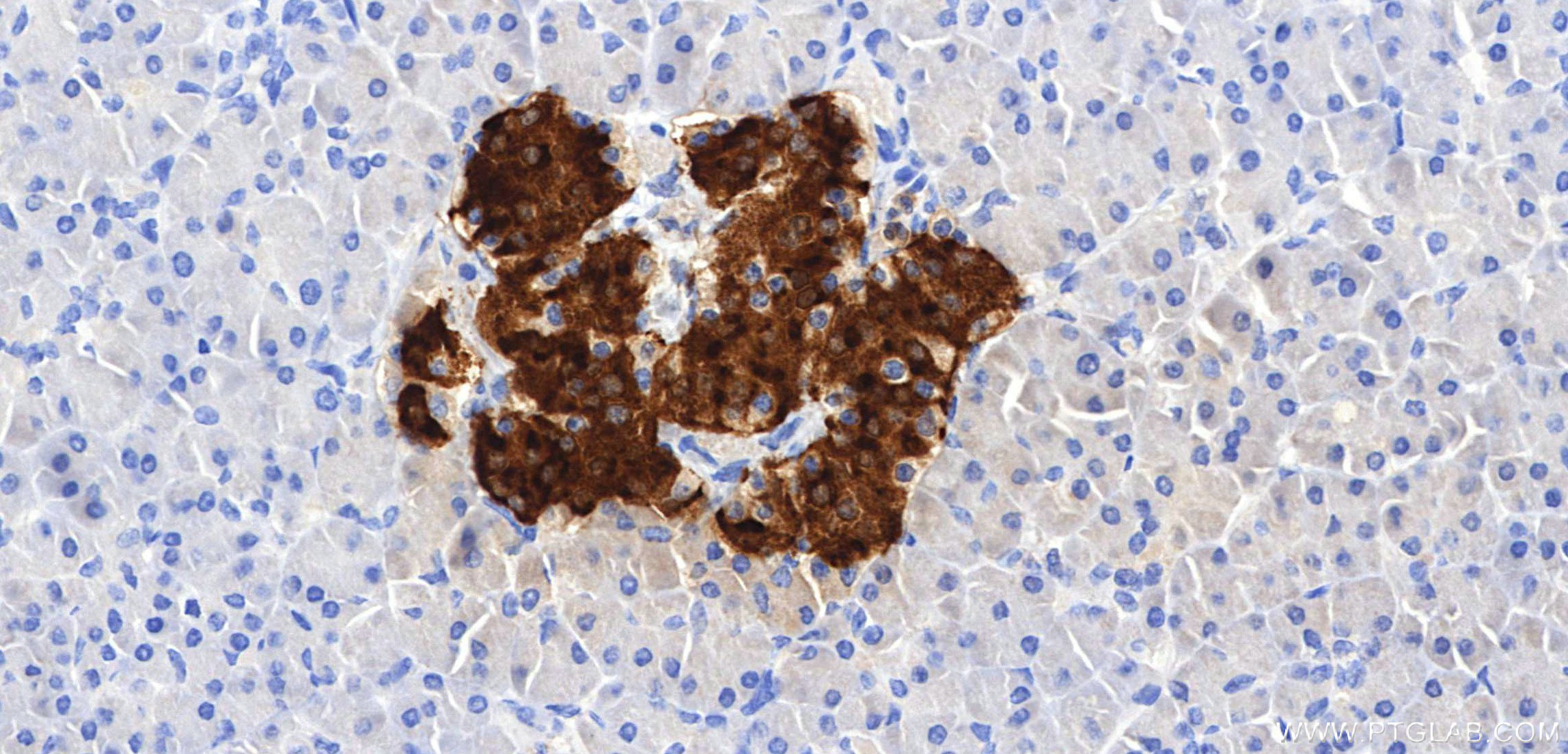 IHC staining of human pancreas using 98867-1-RR IHC staining of human pancreas using 98867-1-RR
