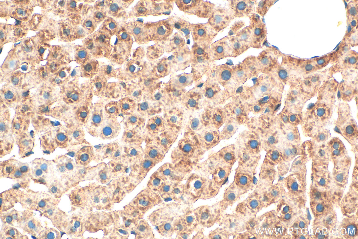 IHC staining of rat liver using 31251-1-AP