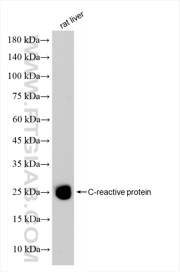 WB analysis of rat liver using 83741-3-RR