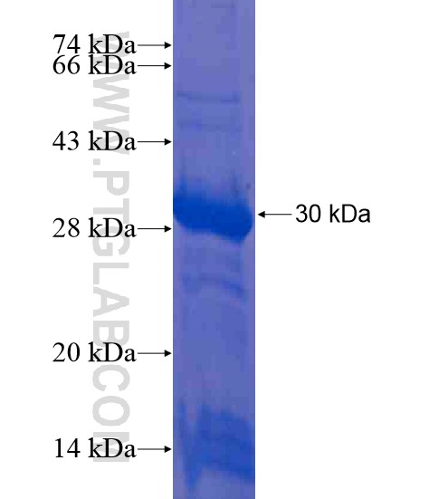 C10orf118 fusion protein Ag21351 SDS-PAGE