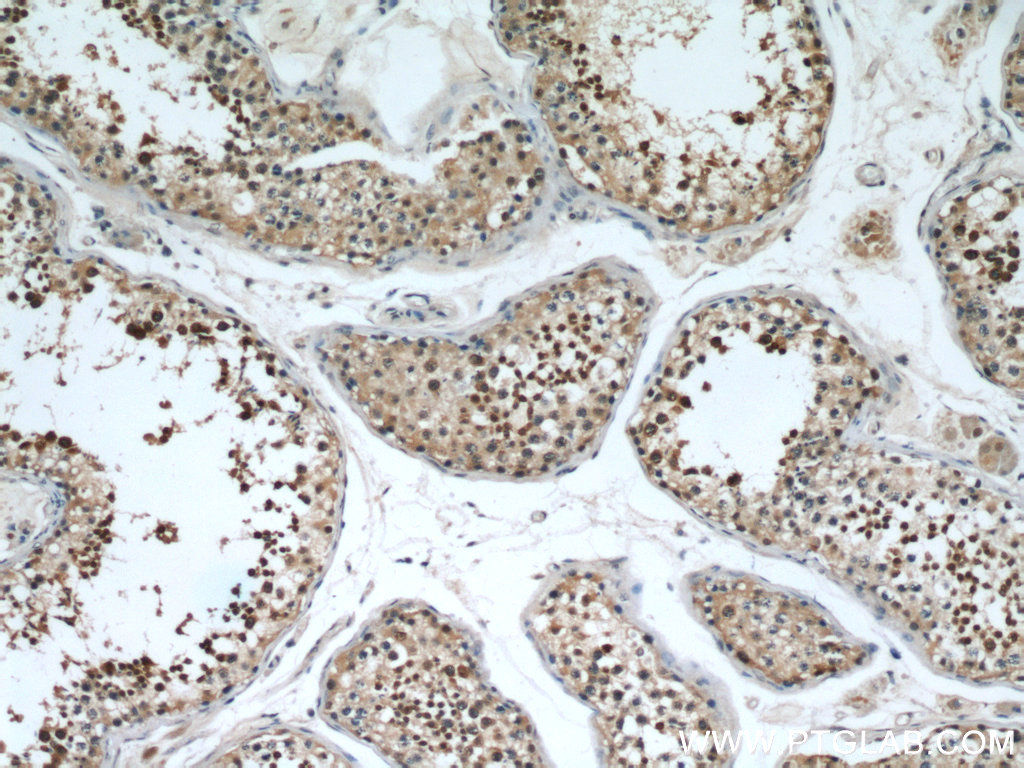 IHC staining of human testis using 21883-1-AP