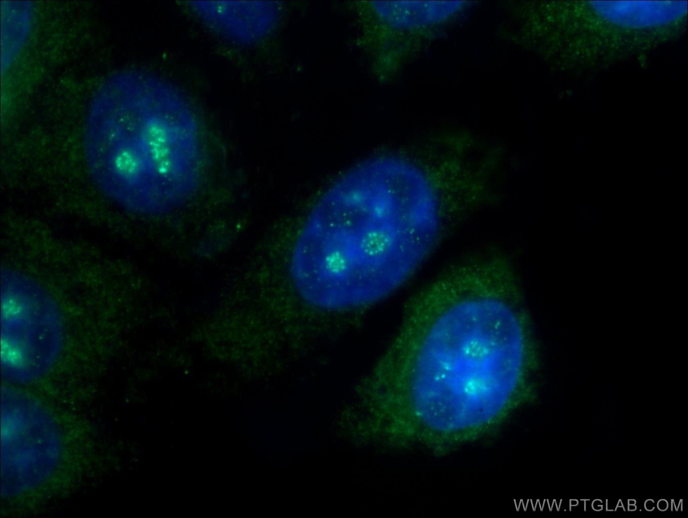 IF Staining of HepG2 using 24967-1-AP