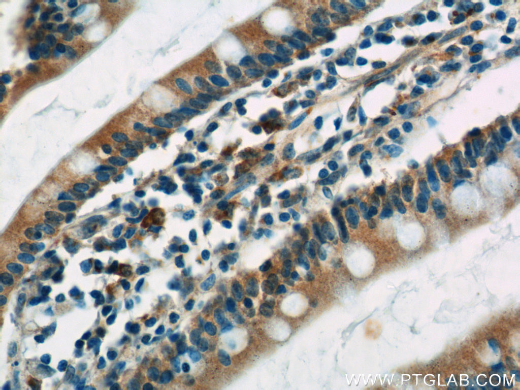 IHC staining of human small intestine using 24967-1-AP