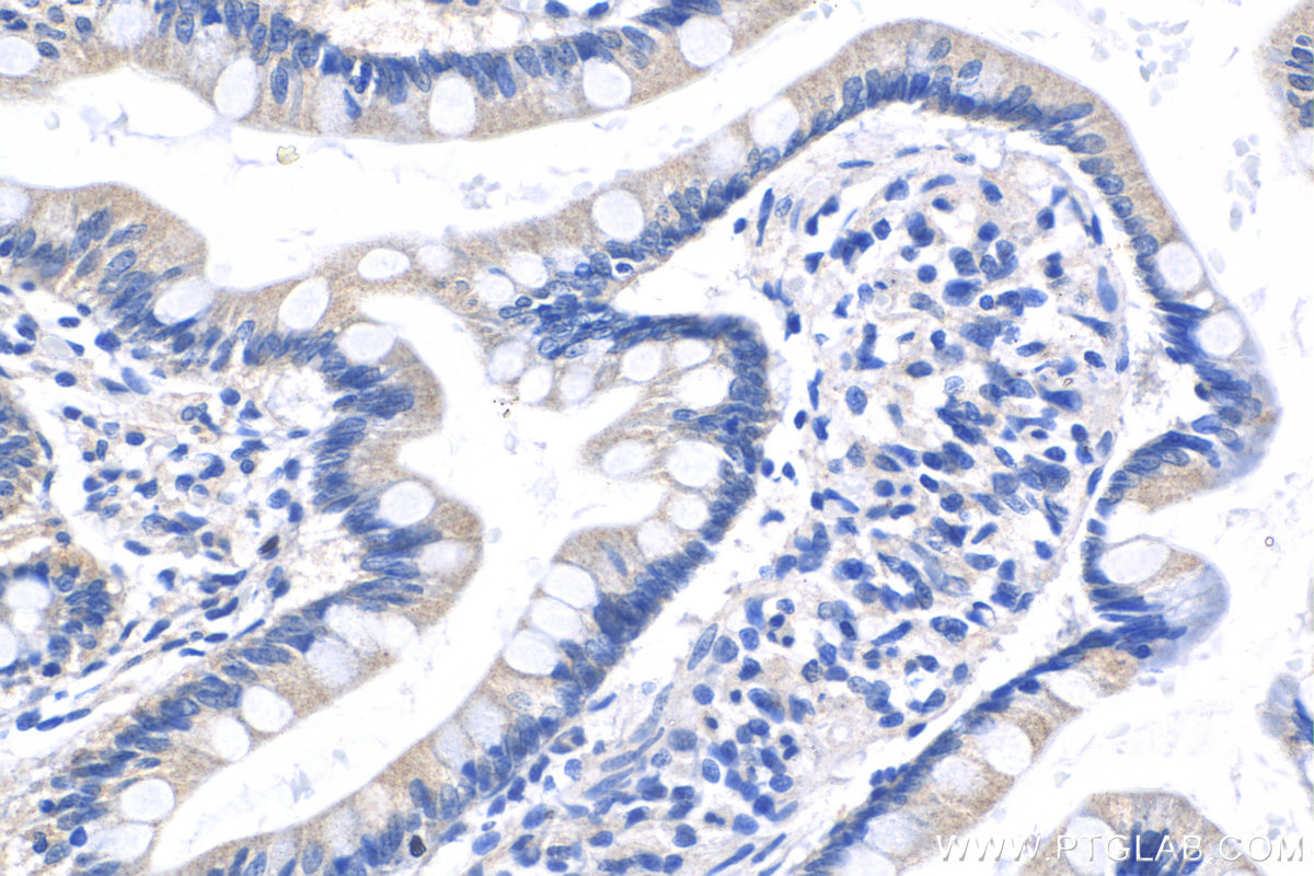 IHC staining of human small intestine using 24967-1-AP