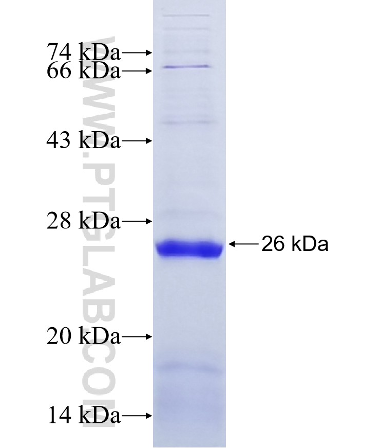 C10orf53 fusion protein Ag15621 SDS-PAGE