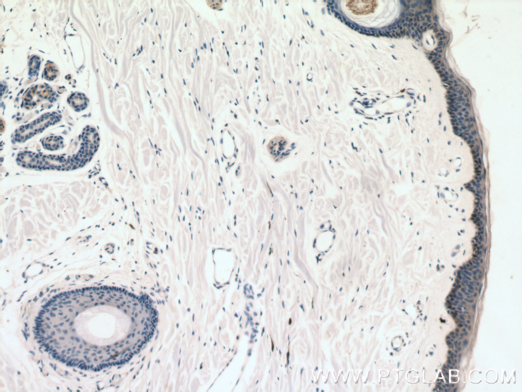 IHC staining of human skin using 20446-1-AP