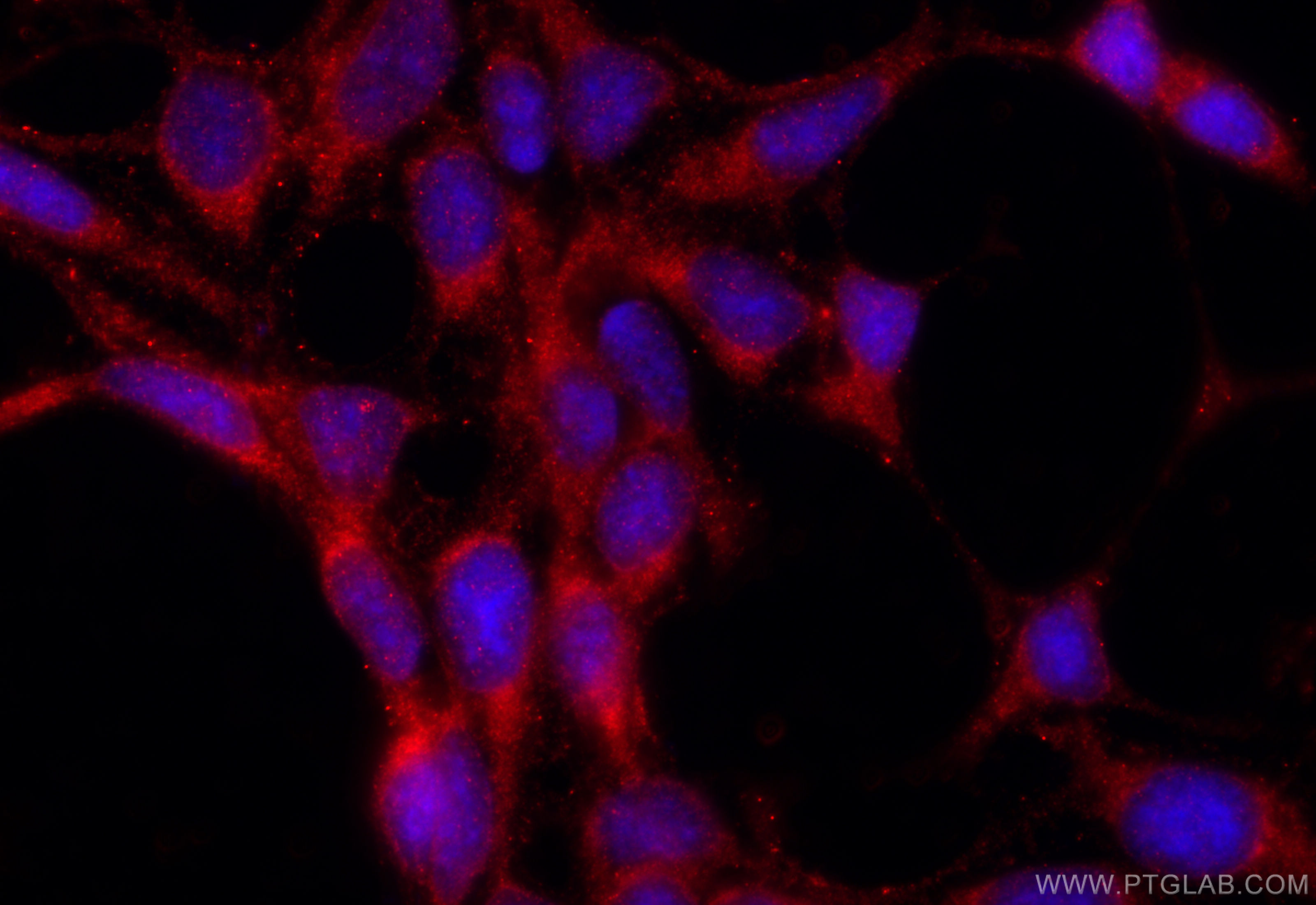 IF Staining of HEK-293 using 24975-1-AP