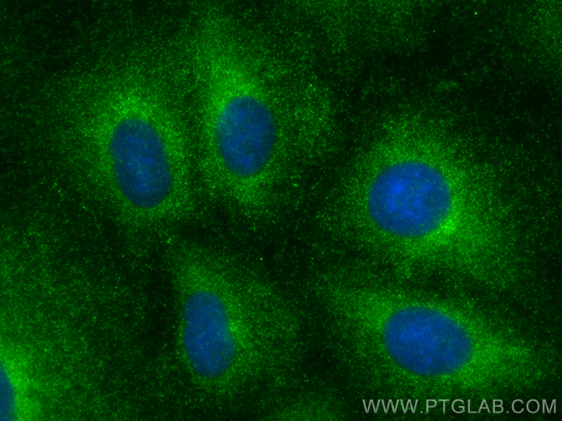IF Staining of A549 using 26026-1-AP
