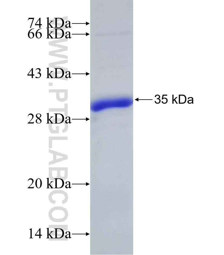 C10orf90 fusion protein Ag32936 SDS-PAGE