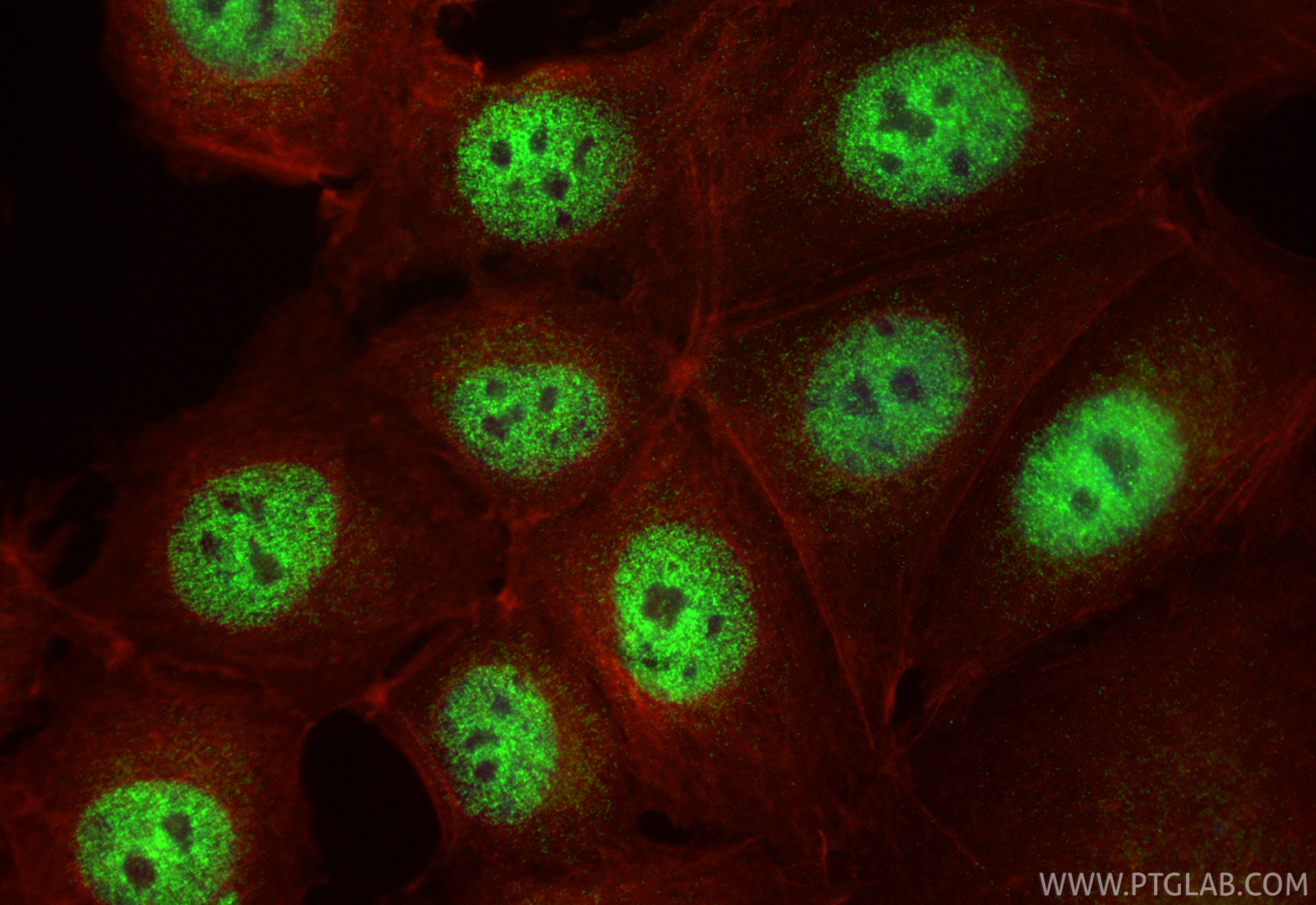 IF Staining of MCF-7 using 26212-1-AP IF Staining of MCF-7 using 26212-1-AP