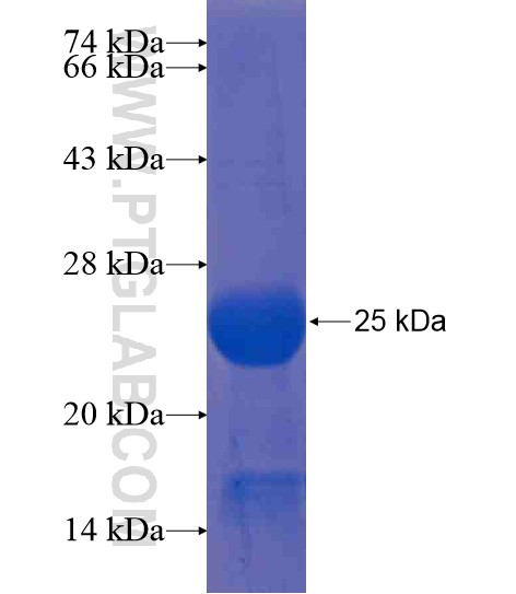 C11orf31 fusion protein Ag20685 SDS-PAGE