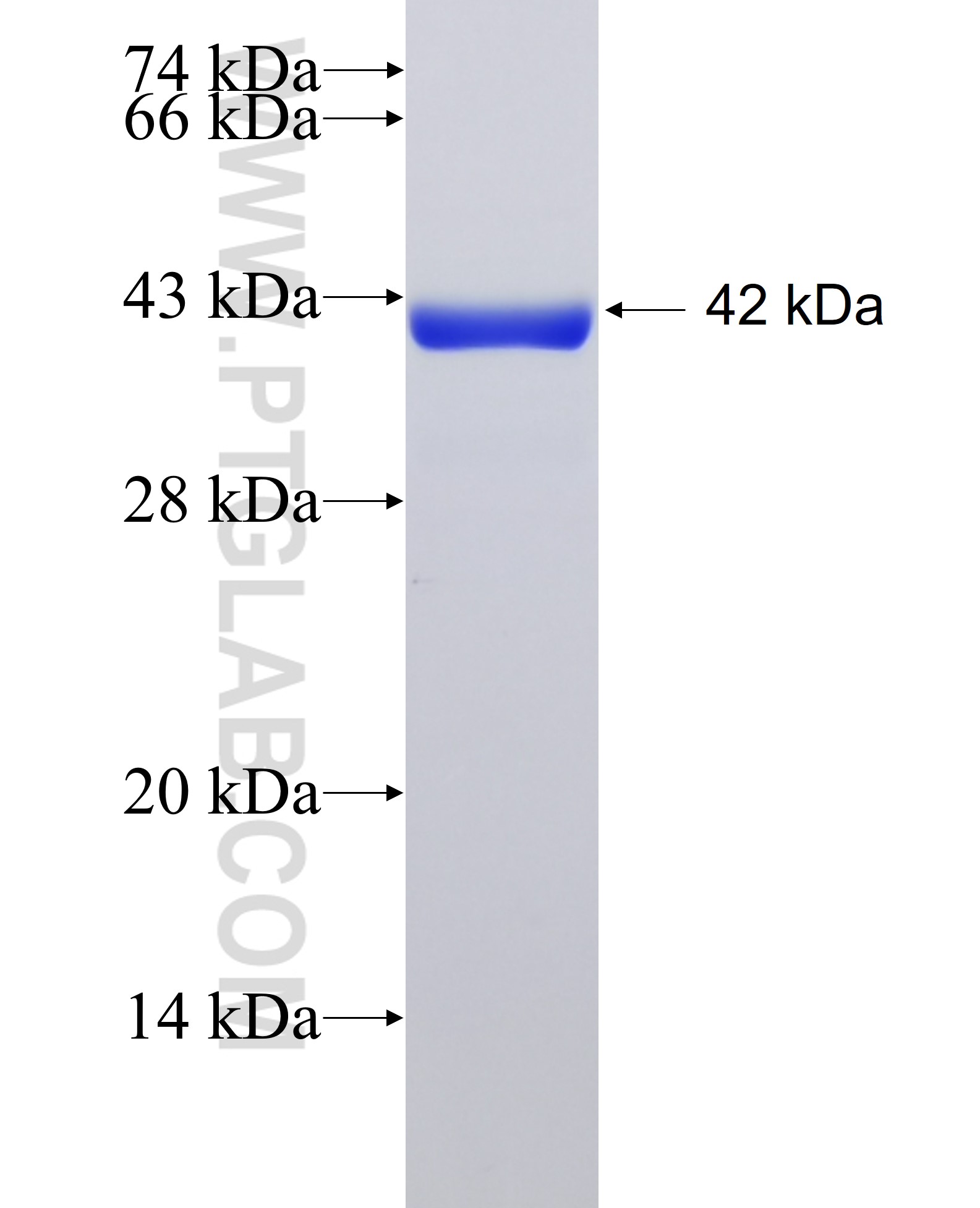 C11orf31 fusion protein Ag38887 SDS-PAGE C11orf31 fusion protein Ag38887 SDS-PAGE