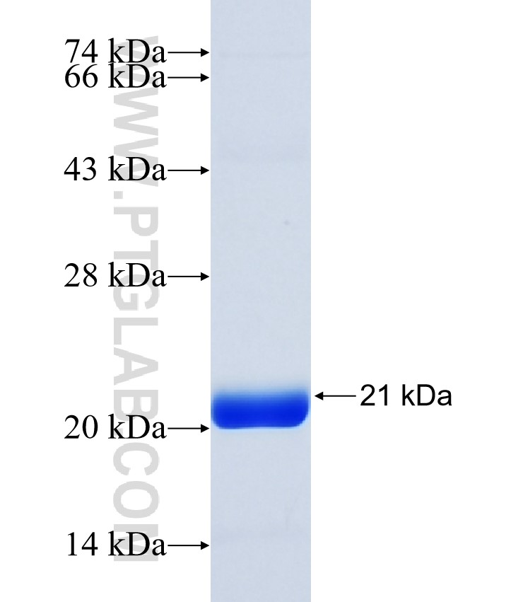 C11orf31 fusion protein Ag38888 SDS-PAGE