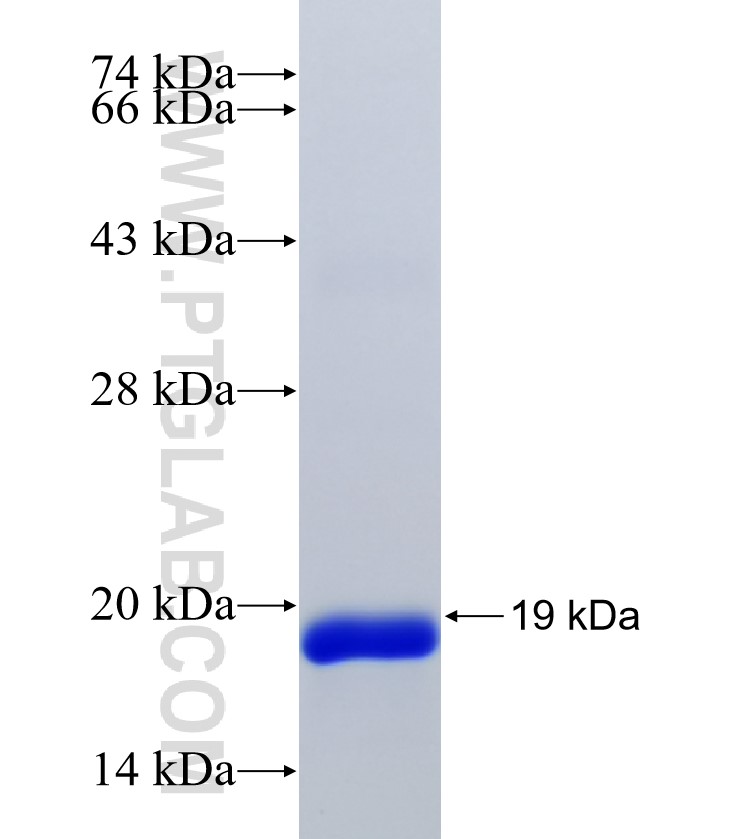 C11orf31 fusion protein Ag38889 SDS-PAGE C11orf31 fusion protein Ag38889 SDS-PAGE