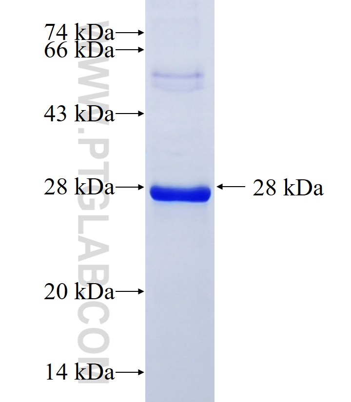C11orf35 fusion protein Ag28100 SDS-PAGE