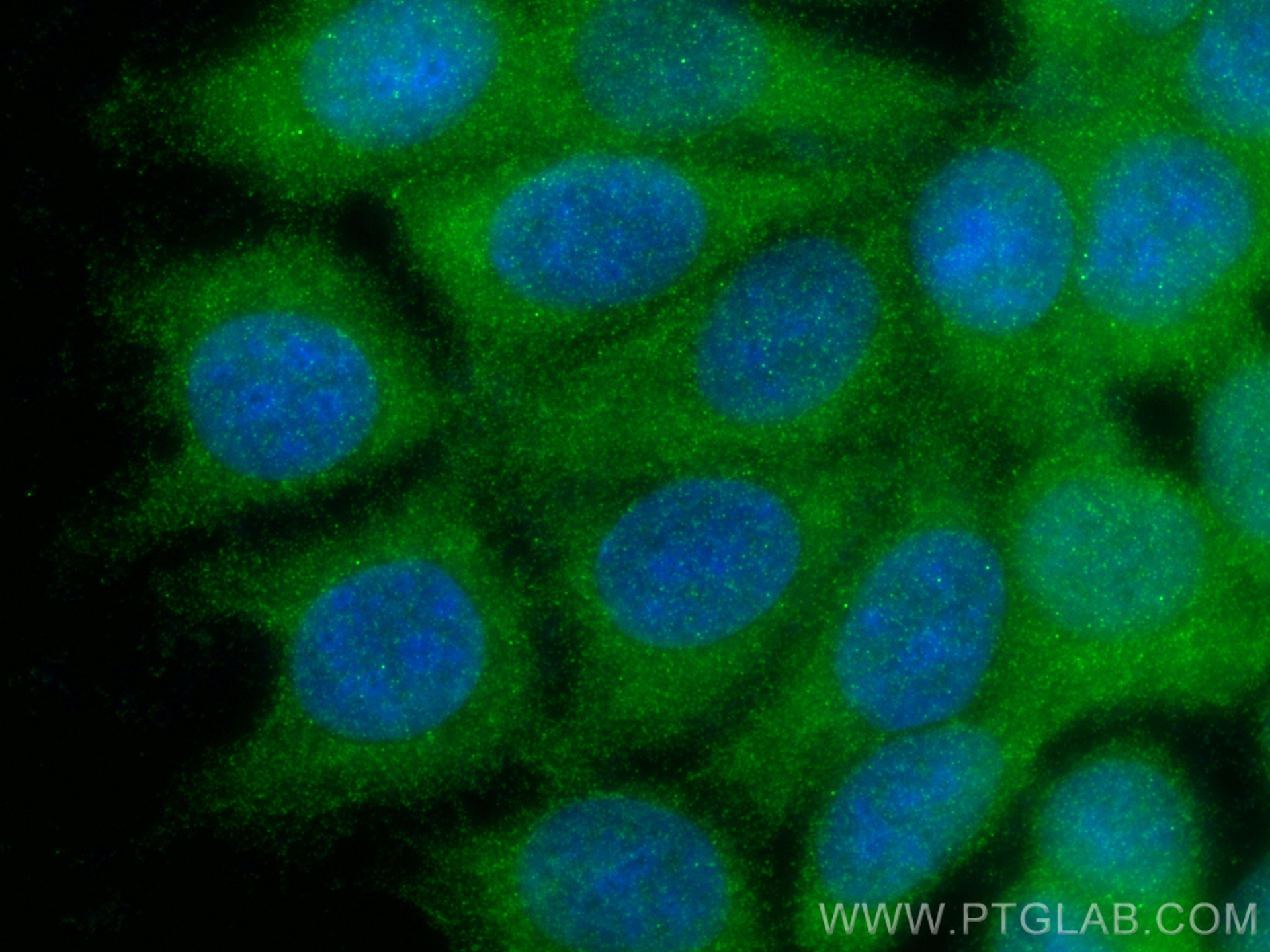 IF Staining of MCF-7 using 20919-1-AP