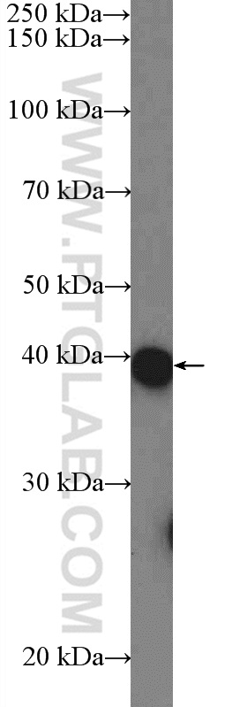 C11orf42