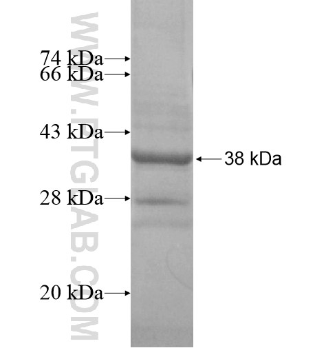 C11orf42 fusion protein Ag15326 SDS-PAGE C11orf42 fusion protein Ag15326 SDS-PAGE