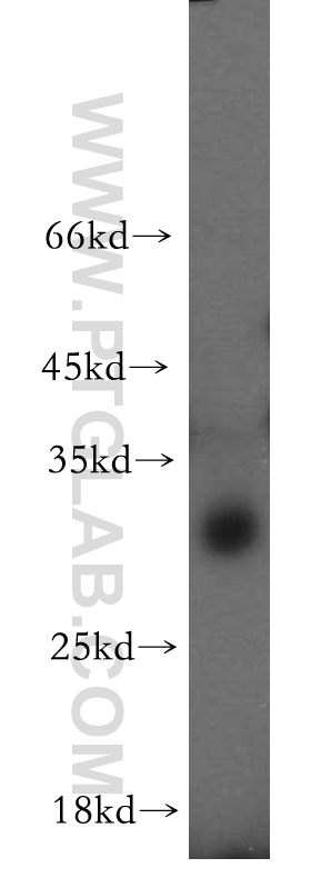 WB analysis of mouse lung using 20195-1-AP
