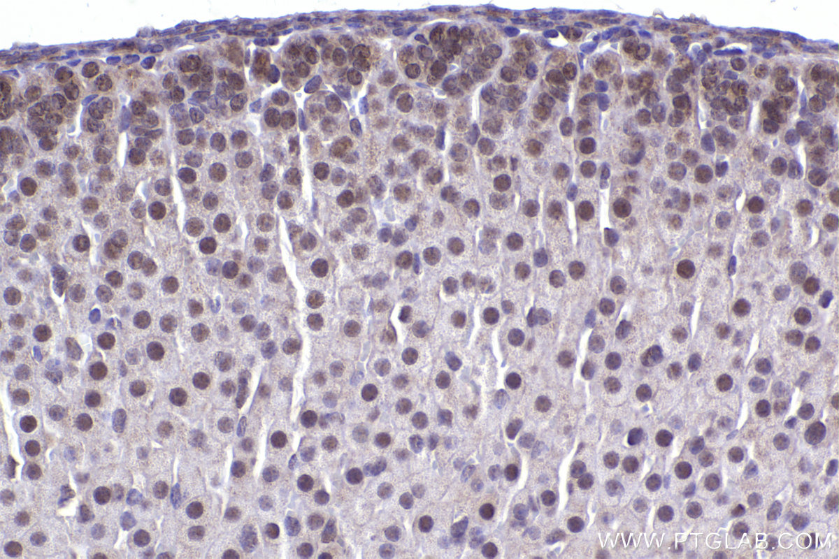 IHC staining of mouse adrenal gland using 20409-1-AP