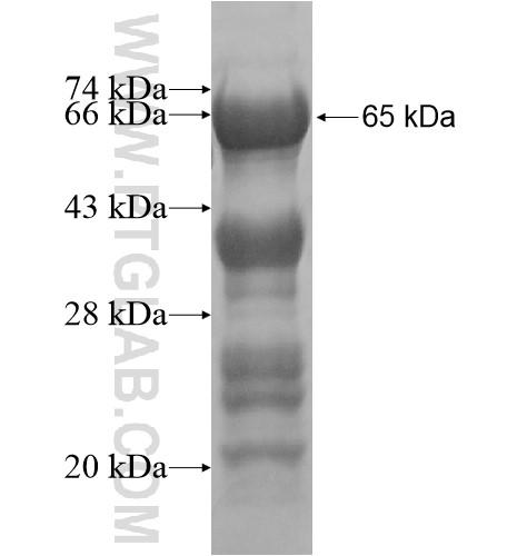 C11orf57 fusion protein Ag15471 SDS-PAGE