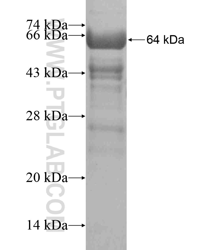 C11orf60 fusion protein Ag18284 SDS-PAGE C11orf60 fusion protein Ag18284 SDS-PAGE