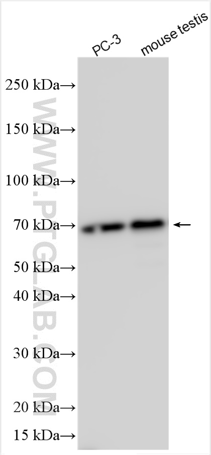 WB analysis using 31747-1-AP (same clone as 31747-1-PBS) WB analysis using 31747-1-AP (same clone as 31747-1-PBS)