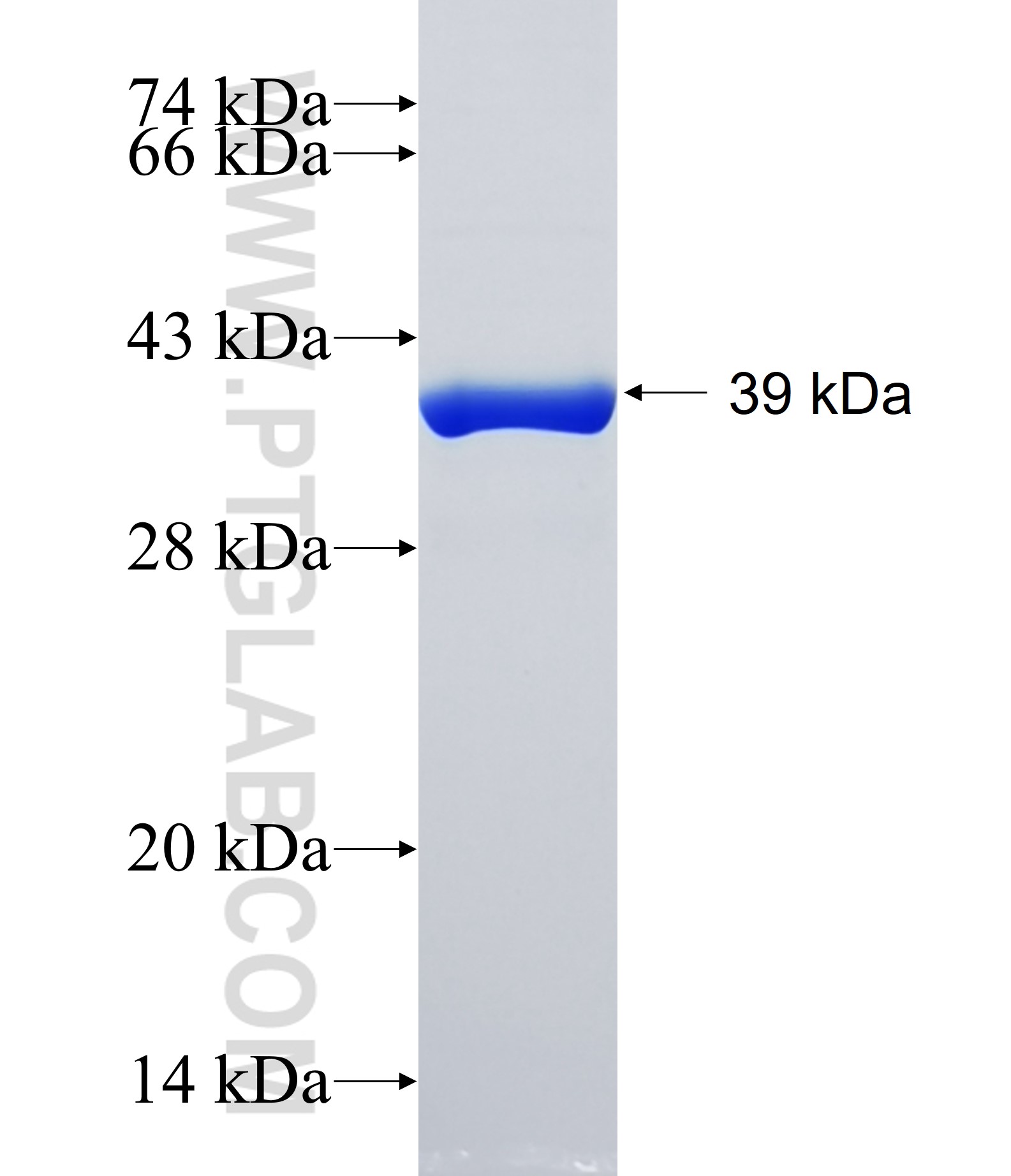 C11orf67 fusion protein Ag14258 SDS-PAGE