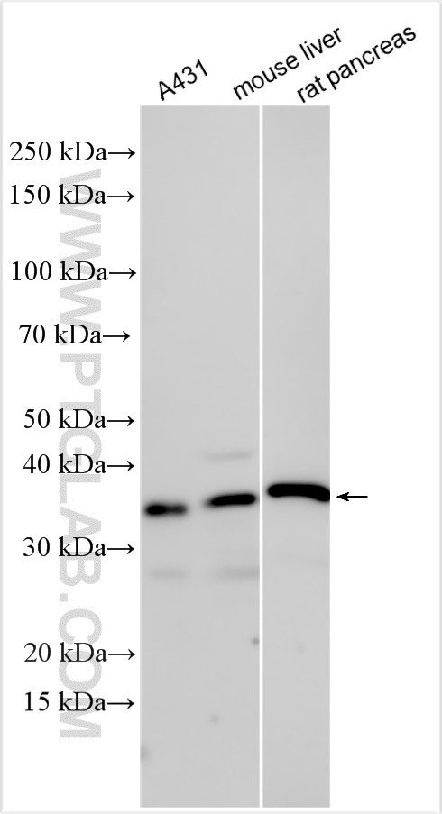 C11orf68
