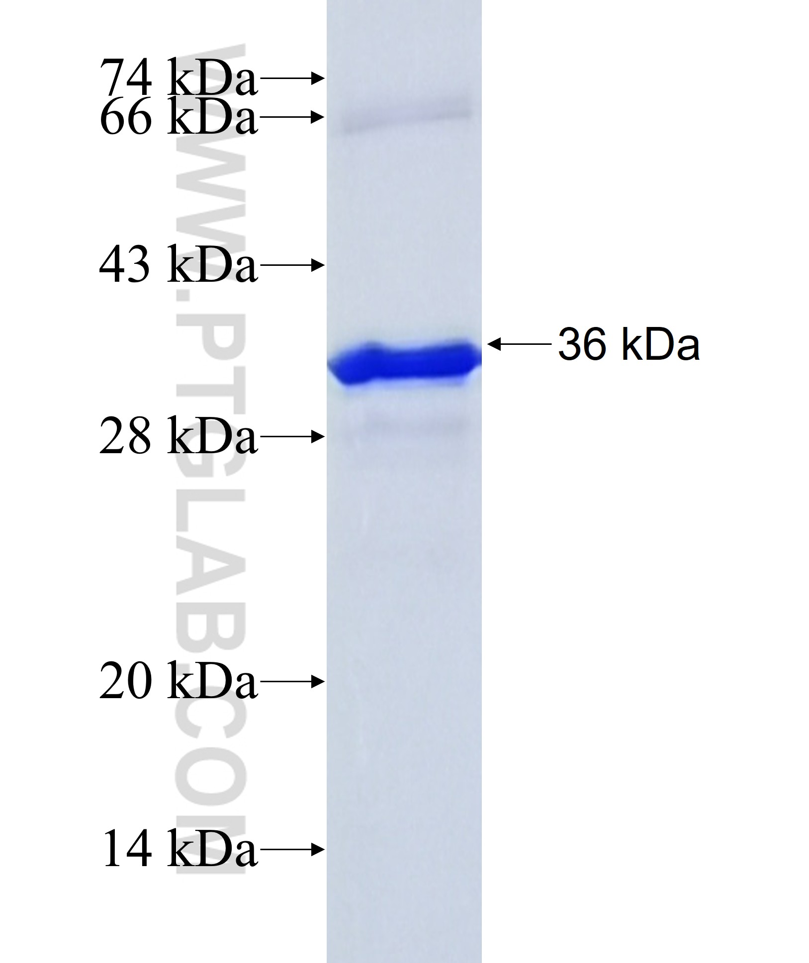 C11orf68 fusion protein Ag36065 SDS-PAGE C11orf68 fusion protein Ag36065 SDS-PAGE