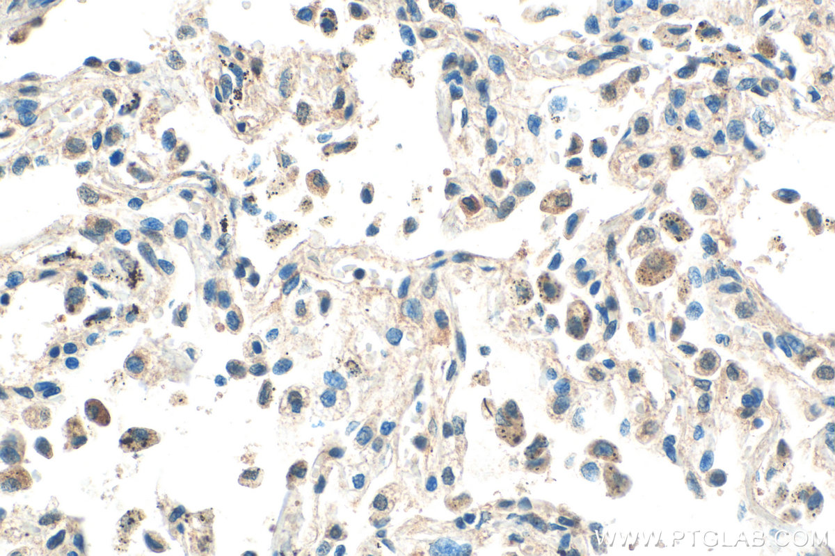 IHC staining of human lung using 14808-1-AP