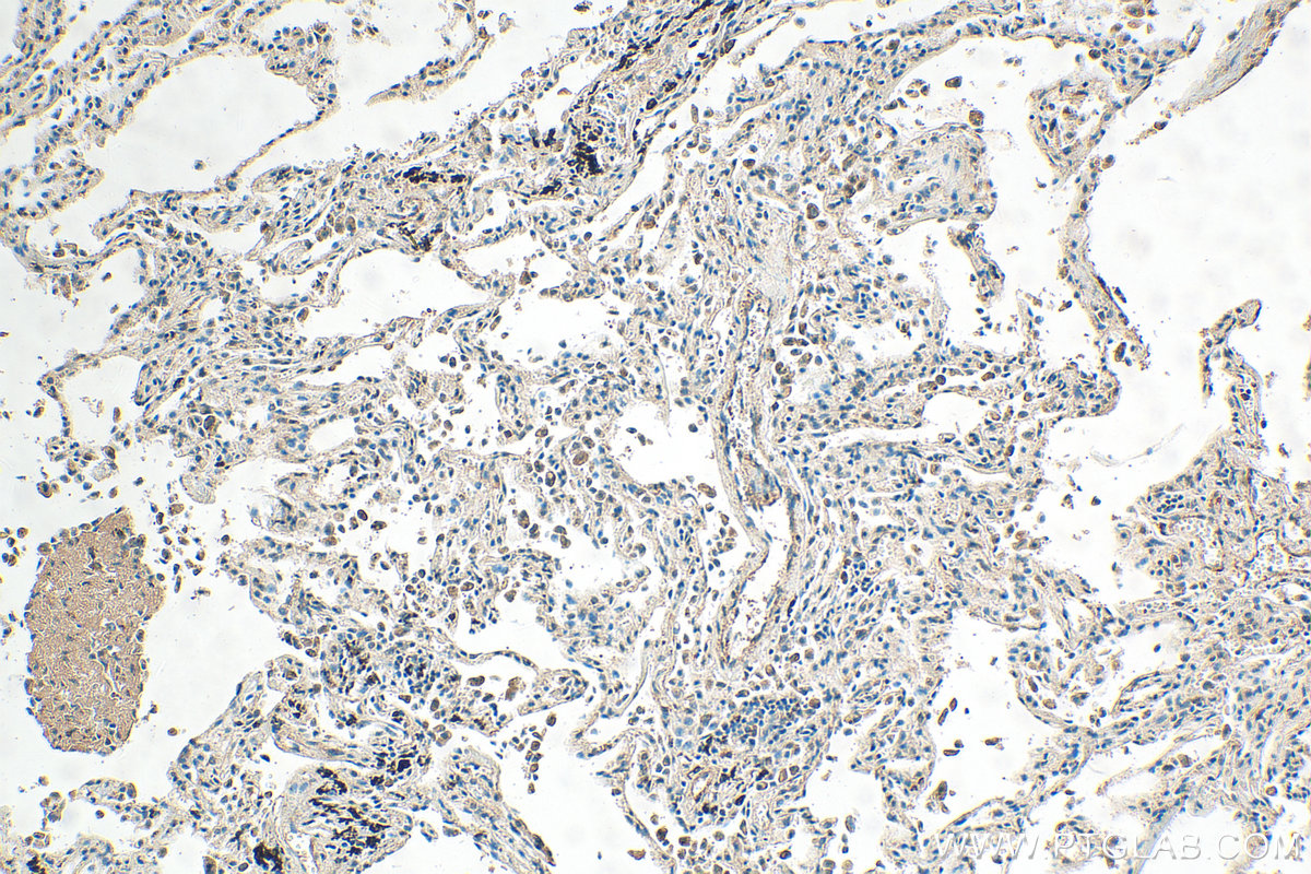 IHC staining of human lung using 14808-1-AP